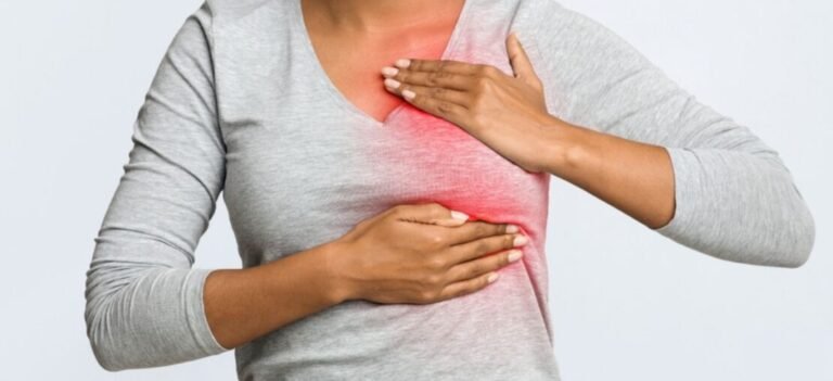 Cáncer de mama inflamatorio: Una forma de rápida evolución que a menudo no presenta un bulto como señal de alarma
